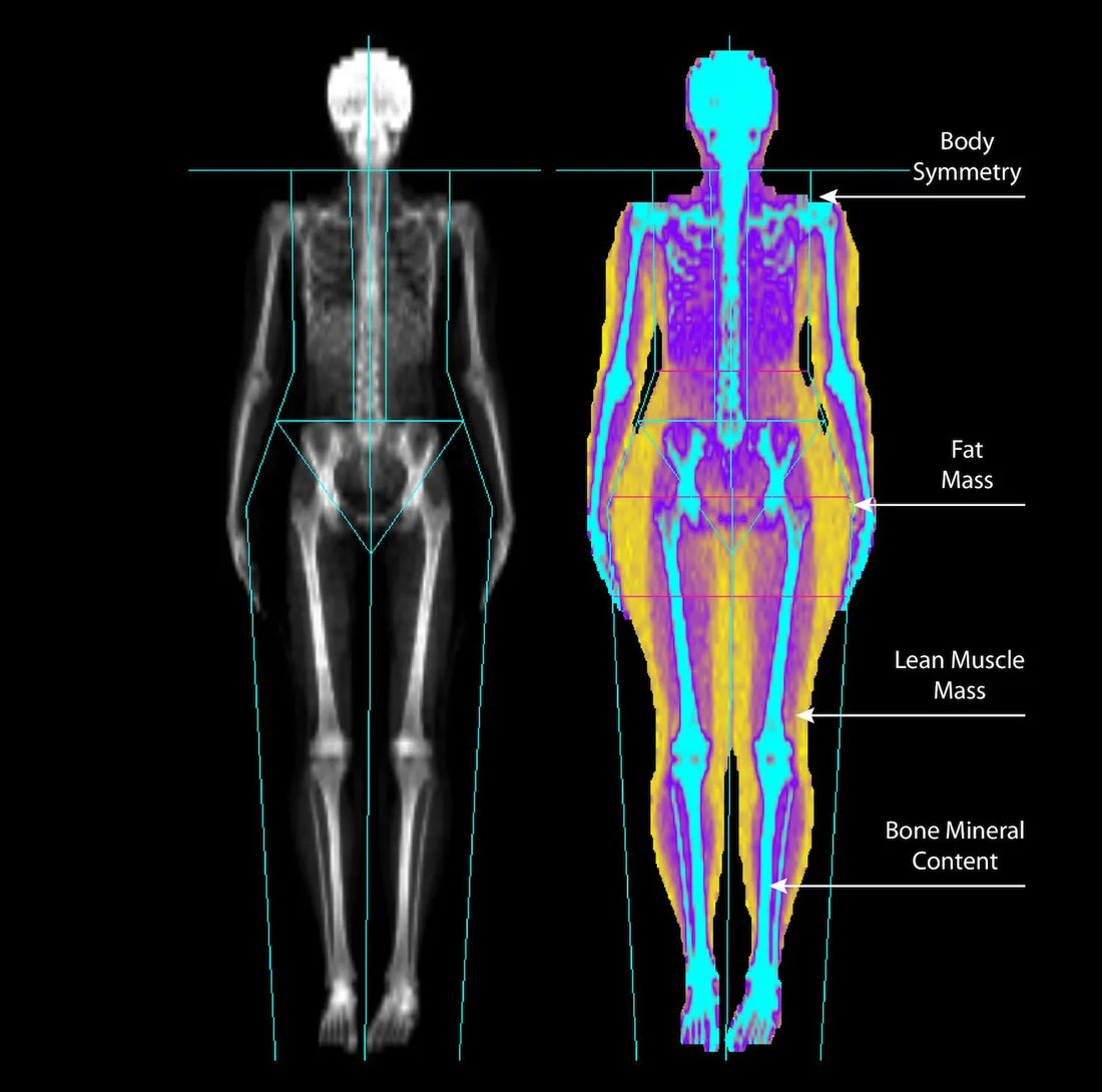 What’s a DEXA Scan and Why Should You Get One?